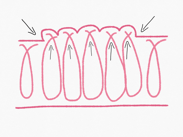 cellulite-collagene-femmnile-beautycologa